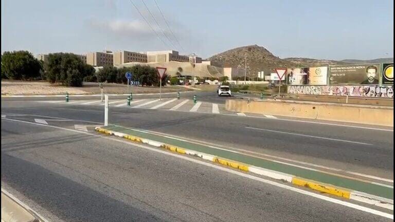 UGT Servicios Públicos denuncia que el Hospital Santa Lucía pretende eliminar tres plazas de Técnicos de Rayos lo que afectará a la calidad asistencial