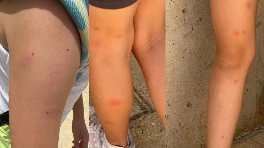 Alarma en colegios de Lorca por plaga de insectos y falta de actuación municipal