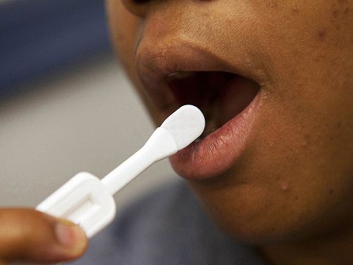 No Te Prives impulsa su segunda Semana Europea de la Prueba del VIH en Murcia No Te Prives impulsa su segunda Semana Europea de la Prueba del VIH en Murcia